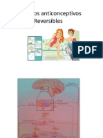 Métodos anticonceptivos Reversibles