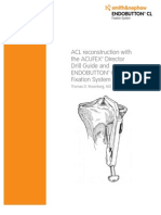 ACL Reconstruction With The ACUFEX™ Director Drill Guide and Endobutton™ CL Fixation System