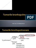 Tumorile bronhopulmonare