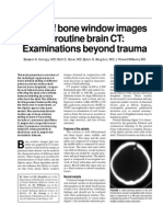 Bone Windows in Brain CT