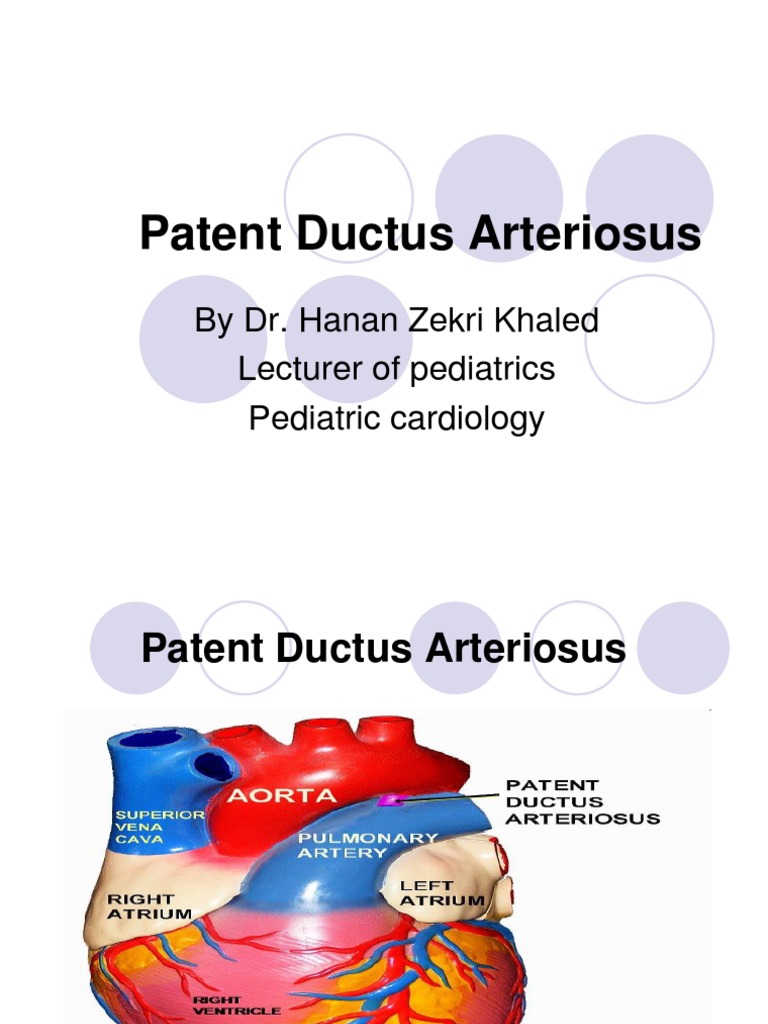 Patent Ductus Arteriosus: by Dr. Hanan Zekri Khaled Lecturer of ...