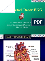 EKG basic