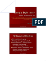 Traumatic Brain Injury Epidural Hematoma