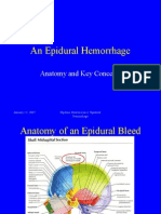 An Epidural Hemorrhage: Anatomy and Key Concepts