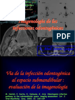 Infecciones Odontogenicas 1