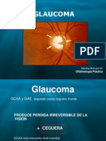 Glaucoma - Dr. Rios