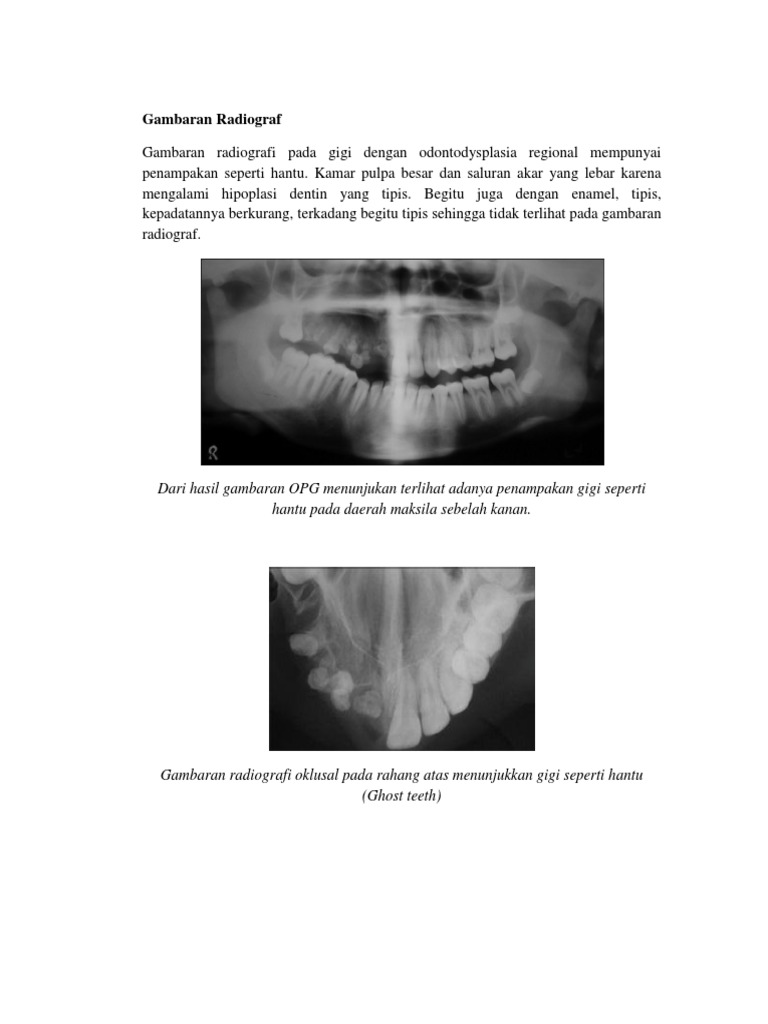 Gambaran Radiograf | PDF