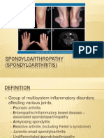 Spondyloarthropathy (Spondyloarthritis) Definition, Features, Assessment and Treatment