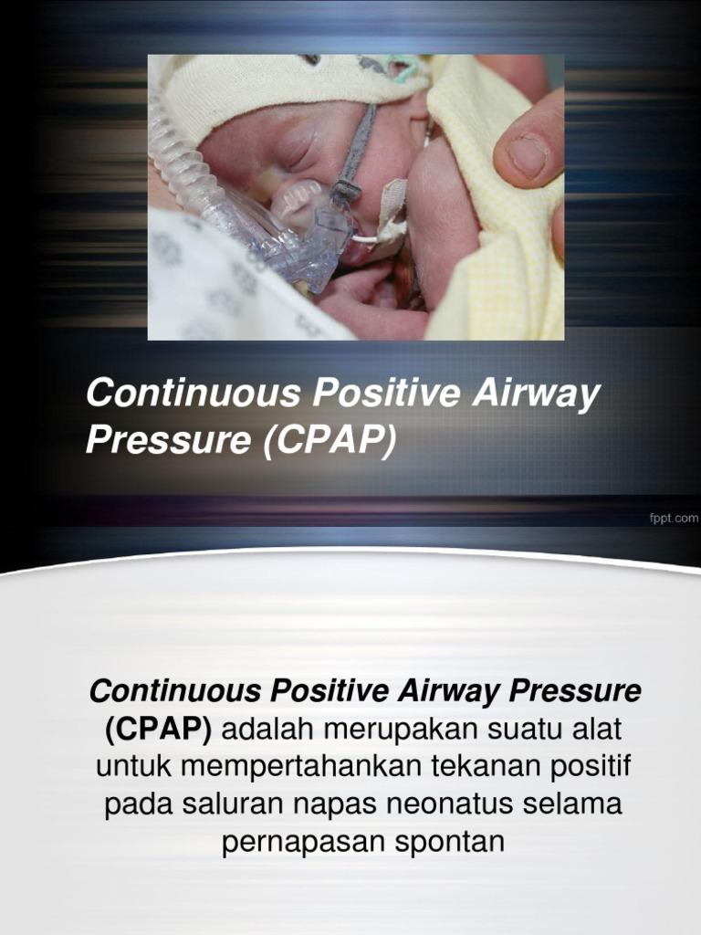 Anak - Cpap | PDF
