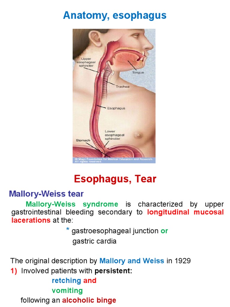 Esophagus Tear Esophagus Stomach