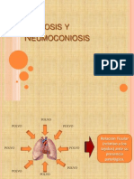 Silicosis y Neumoconiosis