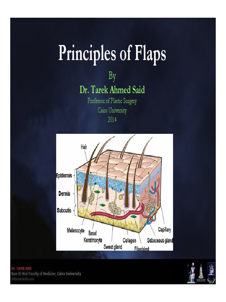 Flaps Surgical Procedures Medical Procedures