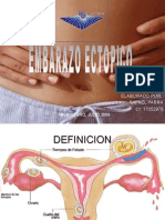 3- Embarazo Ectopico