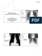 Chest X-Ray Fundamentals