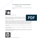 Protocolos Tomografia Axial Computarizada