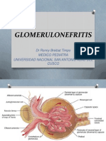 GLOMERULONEFRITIS