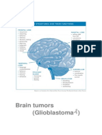 Brain Tumors (Glioblastoma)