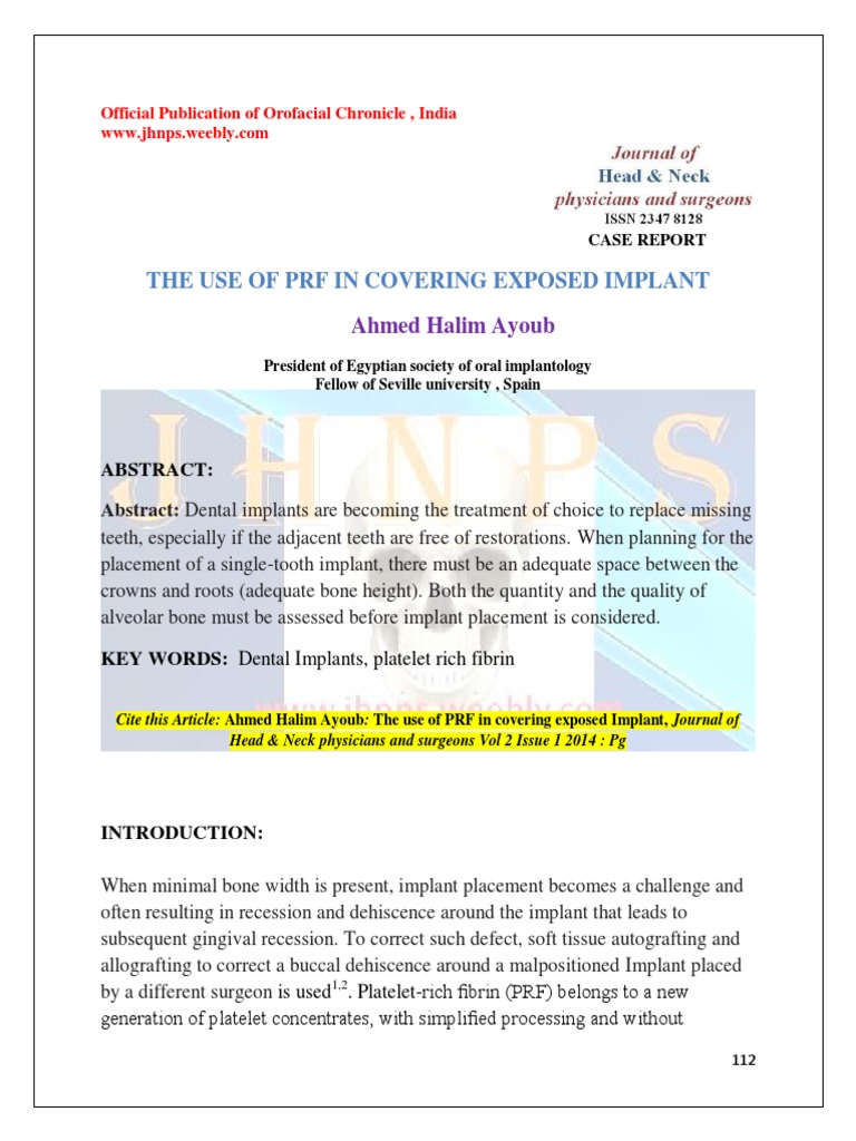The Use of PRF in Covering Exposed Implant PDF Dental Implant Coagulation