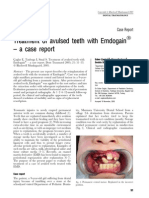 Avulsed Teeth