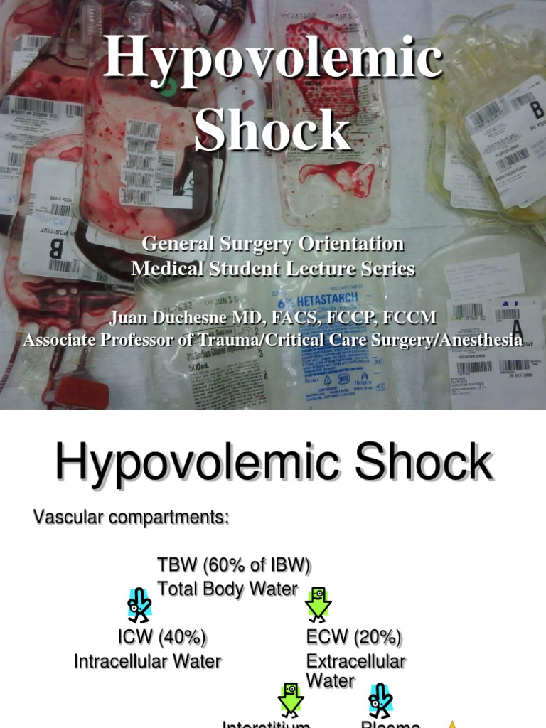 Understanding Hypovolemic Shock in Surgery | PDF | Shock (Circulatory ...