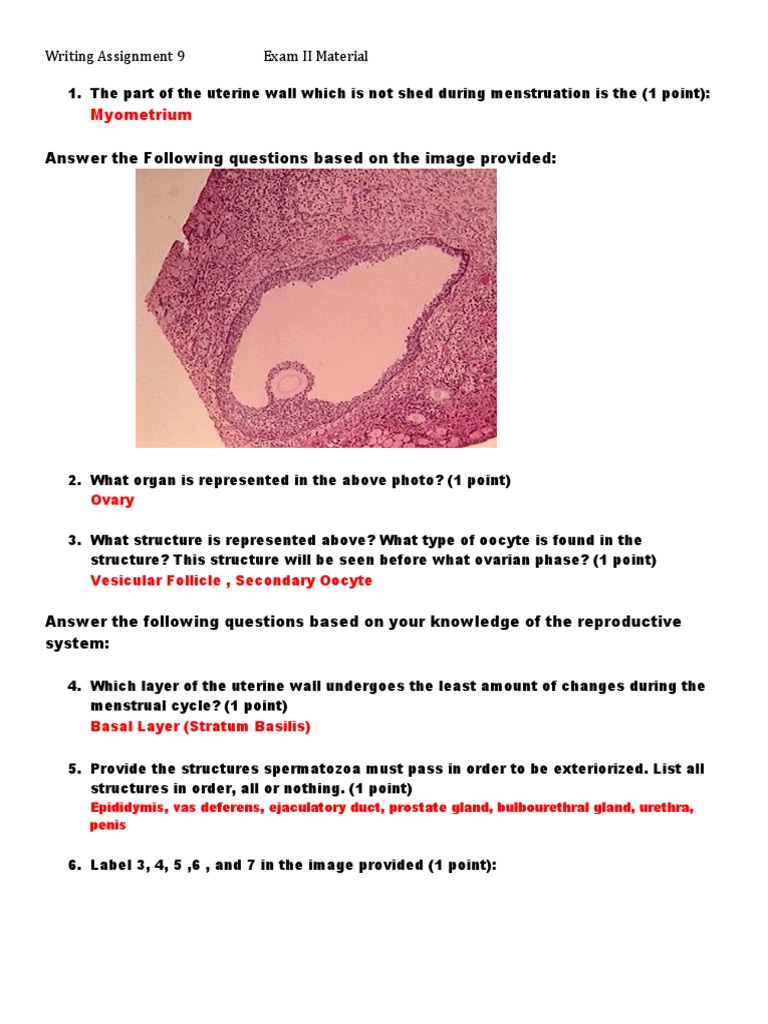 Menstrual cycle symptoms picture