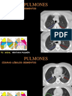 Anatomia Segmentaria Del Pulmn
