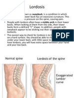 Kyphosis & Lordosis