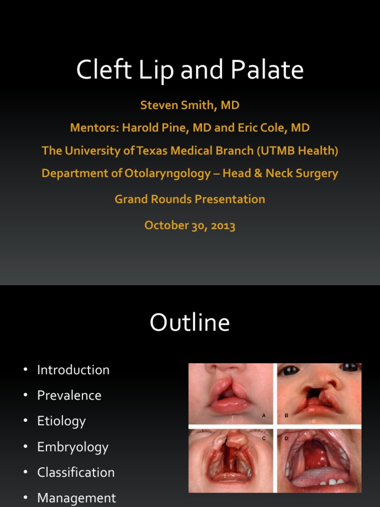 Cleft Lip Palate Pic 2013 10 Human Head And Neck Human Anatomy