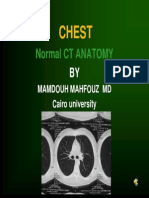 Normal CT Chest