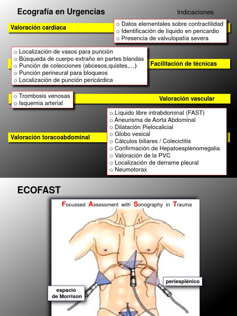 Uso del ECOFAST en Trauma Abdominal | PDF | Tórax (anatomía humana ...
