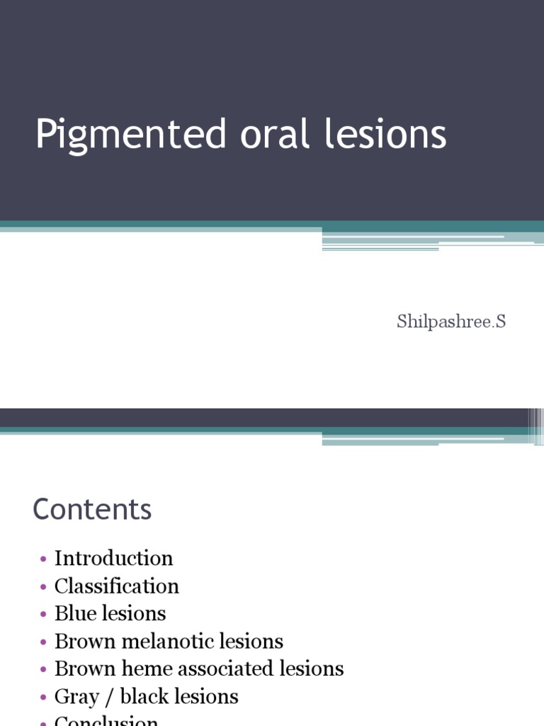 oral melanotic macule ppt Pigmented lesion Pigmented lesions of oral cavity