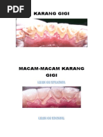 Karang Gigi