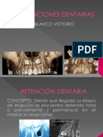 Retenciones Dentarias