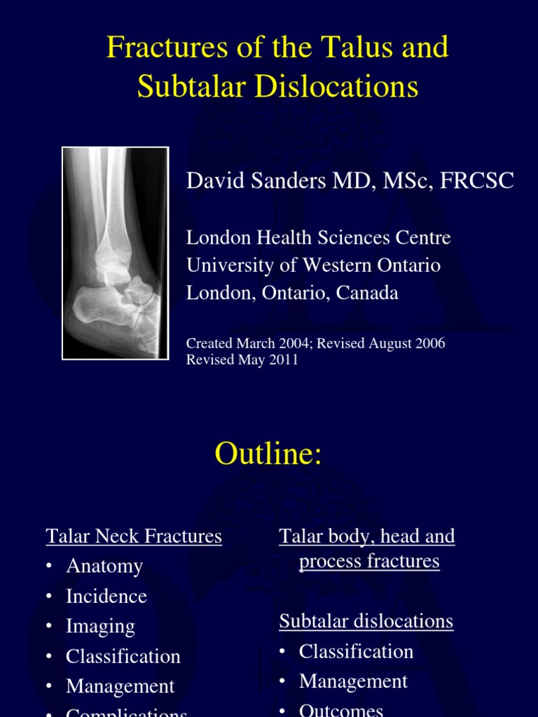 Talar Fractures and Subtalar Dislocations | PDF | Ankle ...