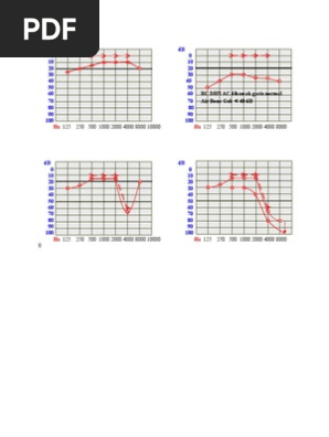 Gb Audiogram