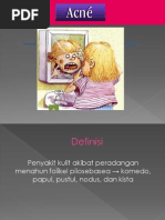 Download Akne by Widya Astri Lintera SN236330260 doc pdf