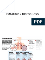 Embarazo y Tuberculosis