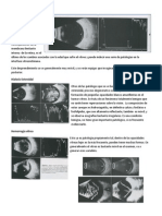 Desprendimientos vitreoretinales: diagnóstico ecográfico