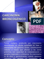 Carcinoma Broncogénico