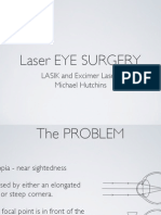 Laser Eye Surgery: LASIK and Excimer Lasers Michael Hutchins