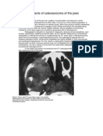 Radiological Aspects of Osteosarcoma of The Jaws