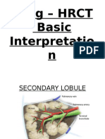 Lung - HRCT Basic Interpretatio N