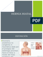 Hernia Hiatal