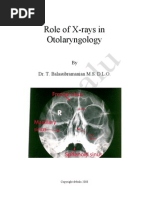 Role Of X Rays In Otolaryngolgoy Esophagus Medical Imaging