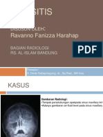 Radiologi Sinus Paranasal