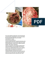Pork Affecting Brain