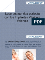 Luce Una Sonrisa Perfecta Con Los Implantes Vitaldent Valencia