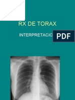 Interpretación de radiografías toracicas