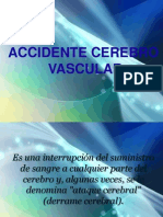 ACV: Causas, síntomas y tratamiento del accidente cerebrovascular