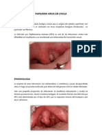 Papiloma Virus en Uvula - Susan
